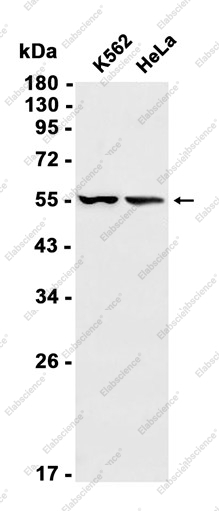 Recombinant Angiopoietin-like 4 Monoclonal Antibody - 1