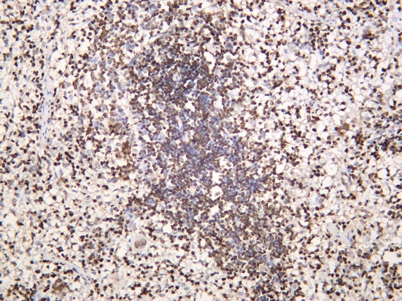Recombinant HMG-2 Monoclonal Antibody - 2