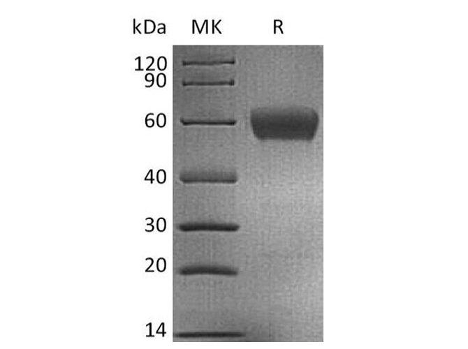 Recombinant Human IL1B Protein(His Tag)-产品推荐-1