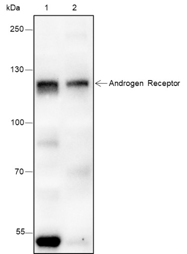 Recombinant Androgen Receptor (CT) Monoclonal Antibody-searchlist-1
