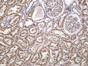 Recombinant RAB27B Monoclonal Antibody - 1