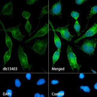 Recombinant EGFR/HER1/ErbB1 Monoclonal Antibody - 3