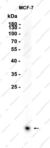 Recombinant TFF1/pS2 Monoclonal Antibody - 1