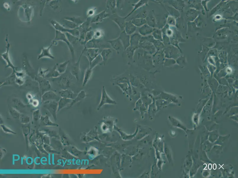 SK-OV-3 Cell Complete Medium - small - 6