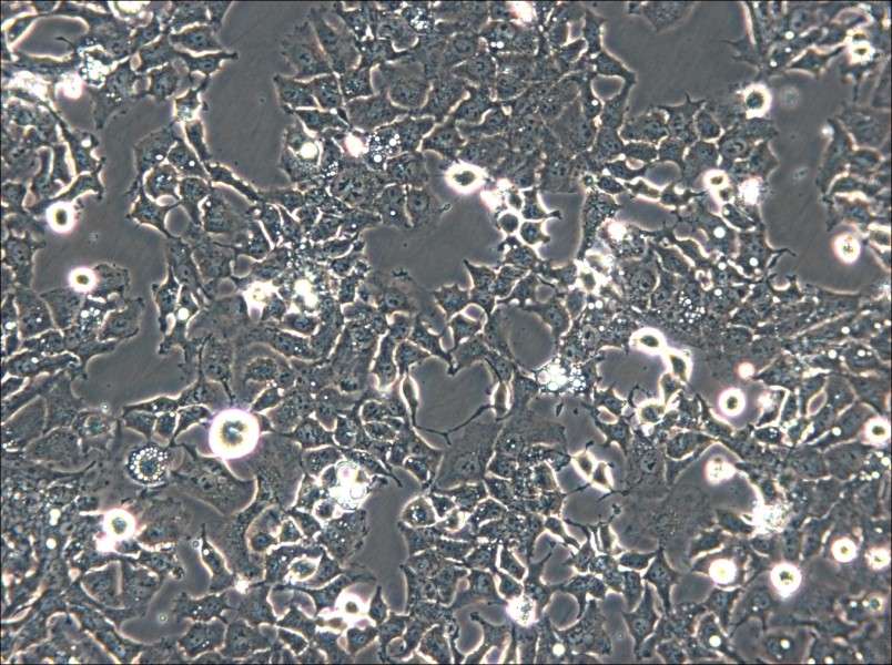 Ishikawa Cell Complete Medium - small - 5