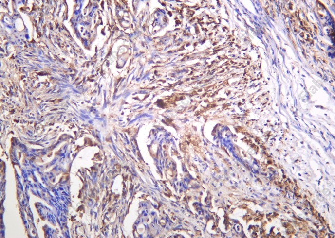 Recombinant Galectin-3 Monoclonal Antibody - 1