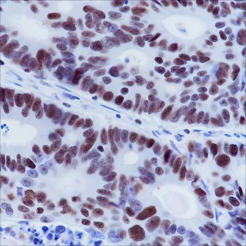 Recombinant MSH6 Monoclonal Antibody - 2