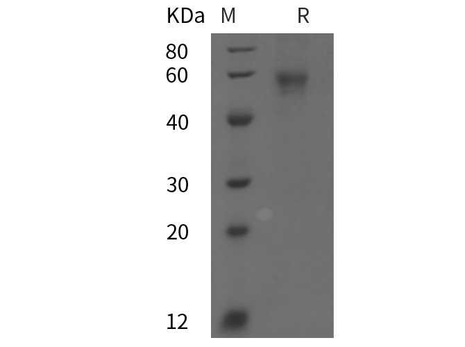 Recombinant Mouse Il6RA/CD126 Protein(His Tag)-1