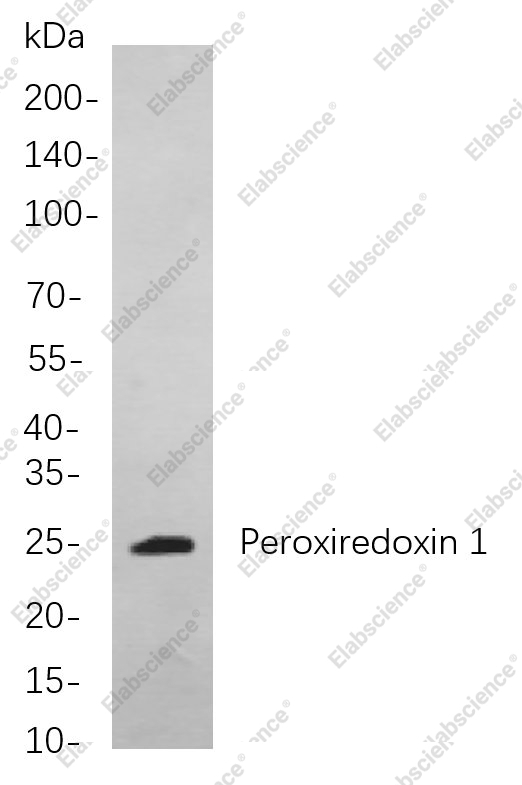Recombinant Peroxiredoxin 1 Monoclonal Antibody - 1