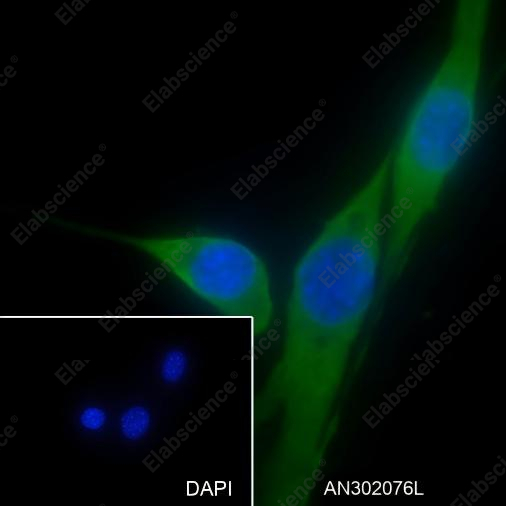 Recombinant Phospho-S6 Ribosomal Protein (Ser235, Ser236) Monoclonal Antibody - 5