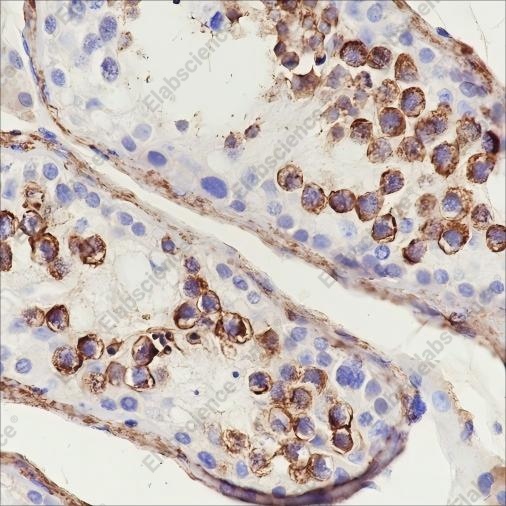 Recombinant Serum Amyloid P/SAP Monoclonal Antibody - 3