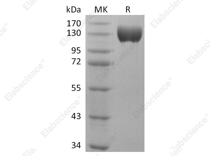Recombinant Human ACE2 Protein (Fc Tag) - 1