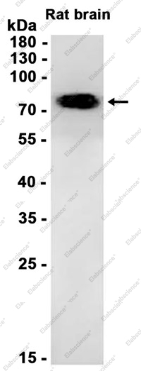 Recombinant Transglutaminase 2 Monoclonal Antibody - 2