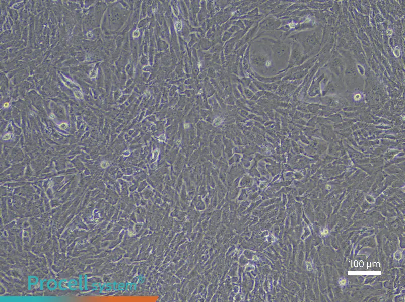 Rabbit Lung Fibroblast Complete Medium - 2