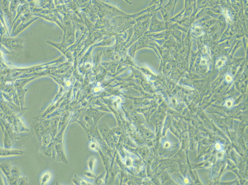 NCI-H1975 Cell Complete Medium - small - 5