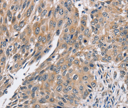 PPP1CC Polyclonal Antibody - 3
