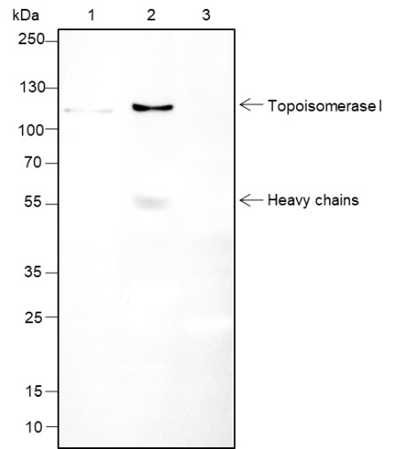 Recombinant Topoisomerase I Monoclonal Antibody - small - 6