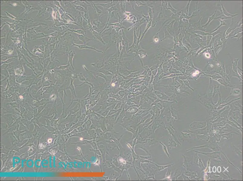 KHM-5M Cell Complete Medium - 1