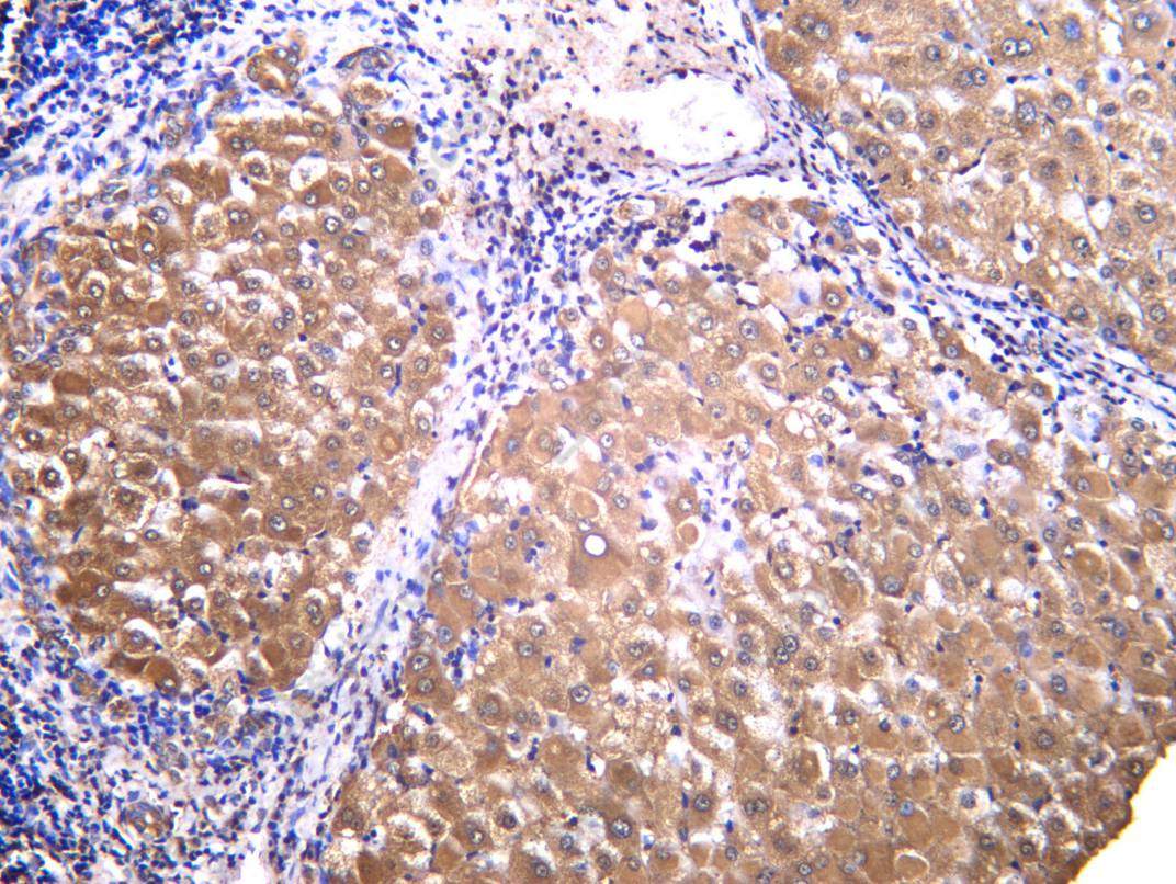 Recombinant L-Lactyl Lysine Monoclonal Antibody - 3
