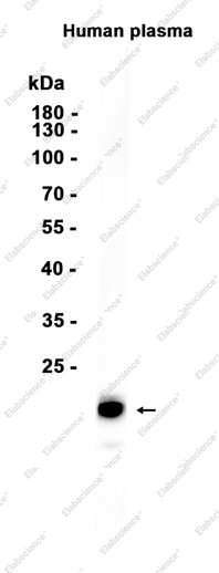 Recombinant Apolipoprotein M Monoclonal Antibody - 1