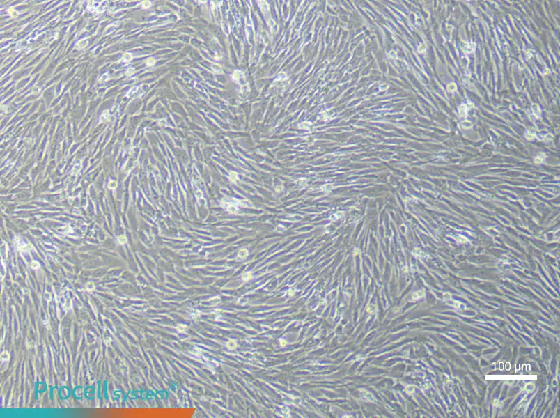 Mouse Pancreatic Stellate (Primary cell immortalization) Cell Complete MediumMouse Pancreatic Stellate (Primary cell immortalization) Cell Complete Medium - 1