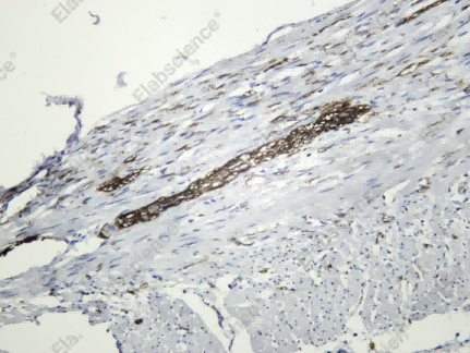 Recombinant CD56 Monoclonal Antibody - 2