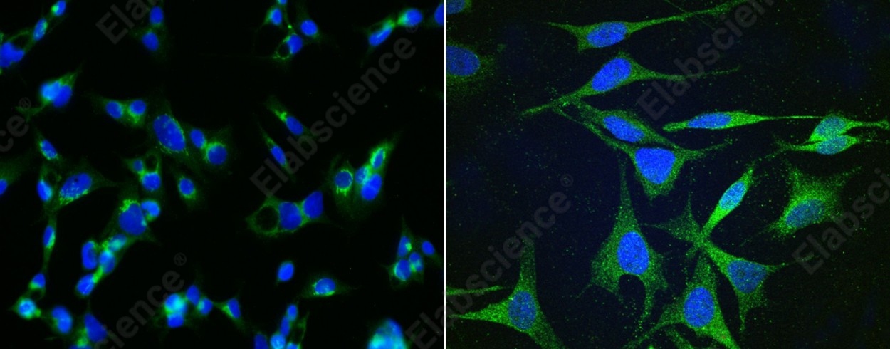 Apolipoprotein H/APOH Monoclonal Antibody - 1