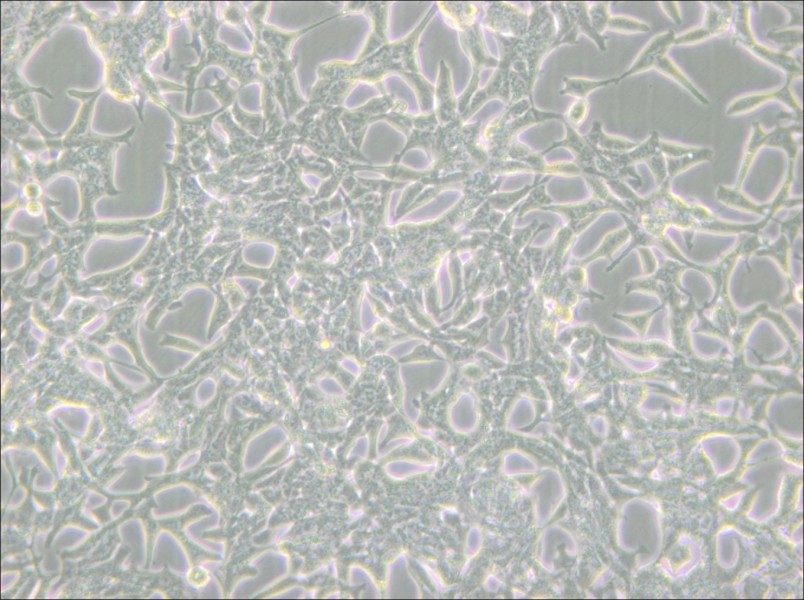 LNCaP clone FGC Cell Complete Medium - 5