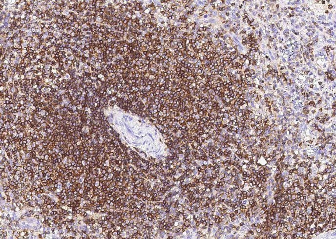 Recombinant CD45/PTPRC Monoclonal Antibody-searchlist-1