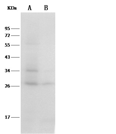 Recombinant Thioredoxin/TXN/SASP Monoclonal Antibody-searchlist-1
