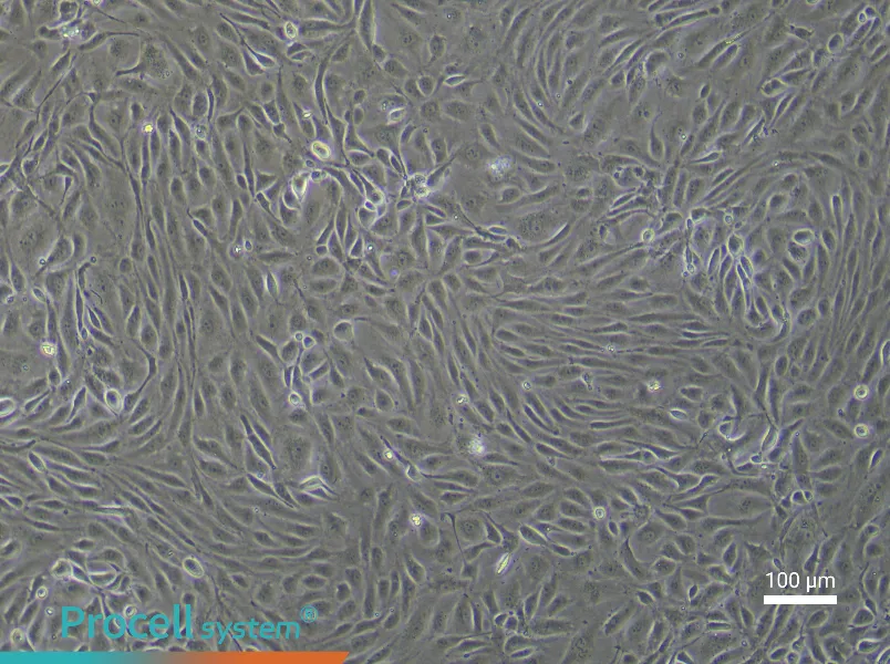 Human Pulmonary Great Vein Endothelial Cell Complete Medium - 3