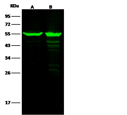 Recombinant ALDH7A1 Monoclonal Antibody - small - 2