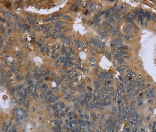FLNA Polyclonal Antibody - 2