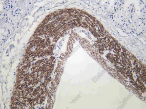 Recombinant Smoothelin Monoclonal Antibody - 3