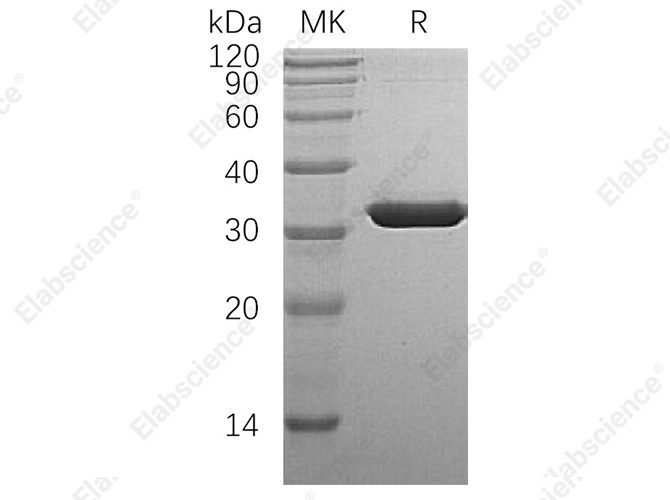 Recombinant Human SULT1A1 Protein (His Tag) - 1