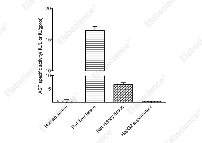 Aspartate Aminotransferase (AST/GOT) Activity Assay Kit - 2