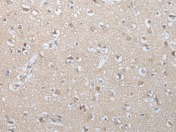 Immunohistochemistry of paraffin-embedded Human brain tissue  using GZMM Polyclonal Antibody at dilution of 1:25(?200)