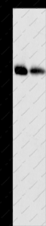 MMP11 Polyclonal Antibody - 1