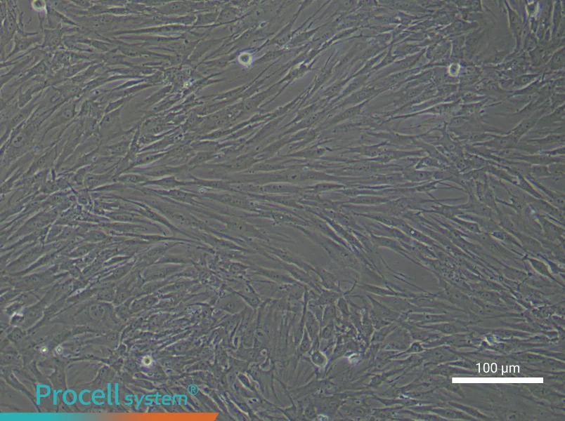 Human Esophageal Cancer Fibroblast Complete Medium - 3