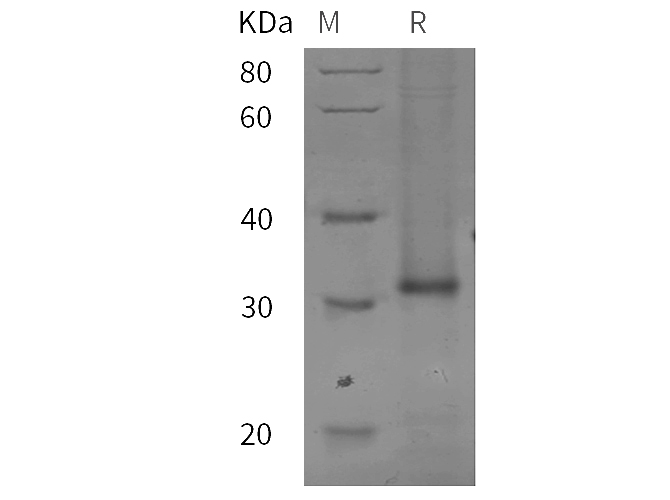 Recombinant Mouse Ifna1 Protein(His Tag)-产品推荐-1