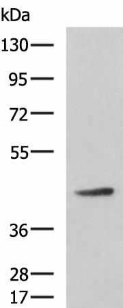 Western blot analysis of Hela cell lysate  using ARPC1B Polyclonal Antibody at dilution of 1:800