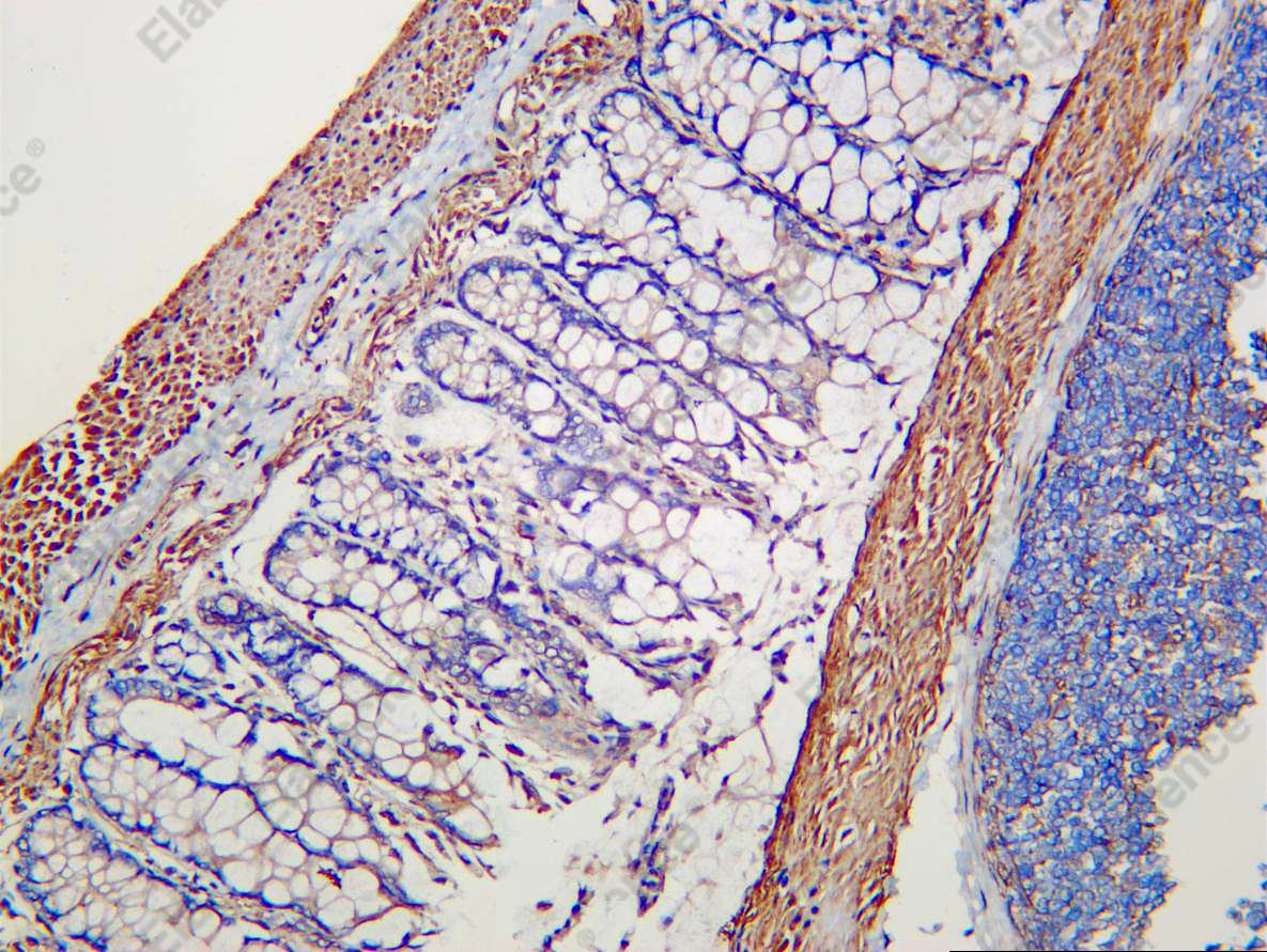 Recombinant Arrestin-β-1 Monoclonal Antibody - 3