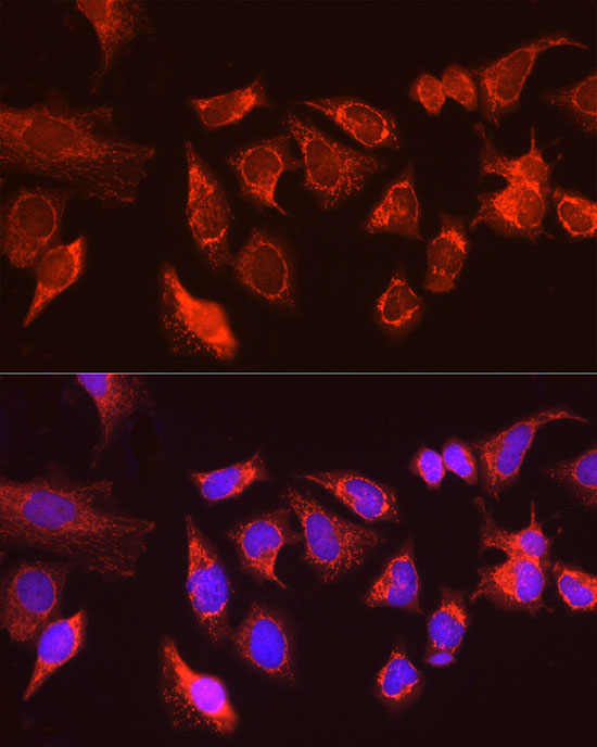 Immunofluorescence analysis of HeLa cells using ATG13 Polyclonal Antibody at dilution of 1:100 (40x lens). Blue: DAPI for nuclear staining.