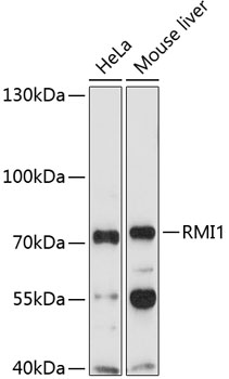 Western blot analysis of extracts of various cell lines using RMI1 Polyclonal Antibody at 1:1000 dilution.