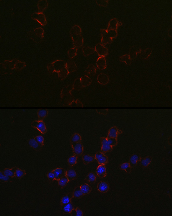 Immunofluorescence analysis of Jurkat cells using CCR5 Polyclonal Antibody at dilution of 1:50 (40x lens). Blue: DAPI for nuclear staining.