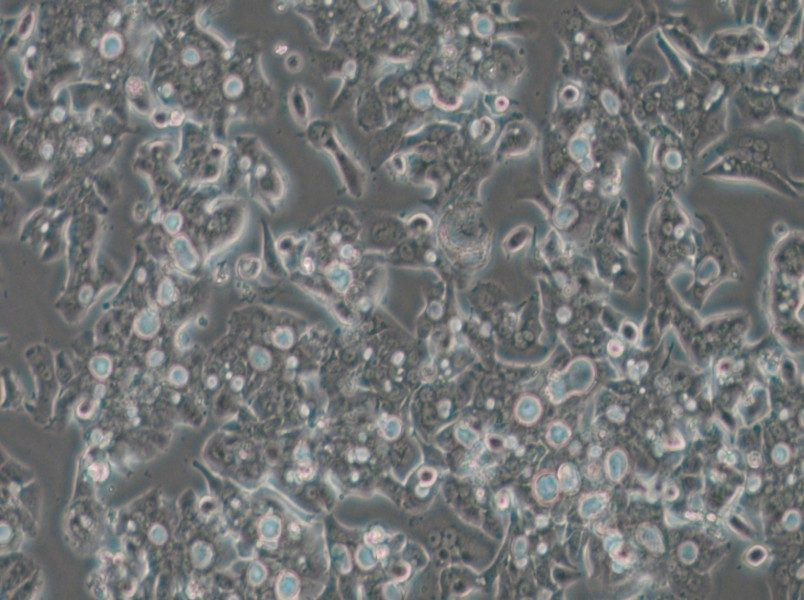 OE19 Cell Complete Medium - 6
