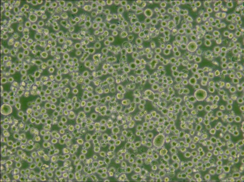 U266 [U266B1] Cell Complete Medium - small - 4