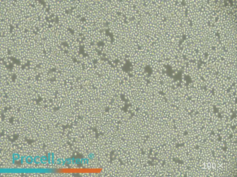 P3/NSI/1-Ag4-1 [NS-1] Cell Complete Medium - 2