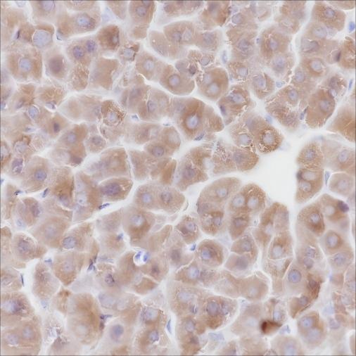 Recombinant ALDH1L1 Monoclonal Antibody - small - 3