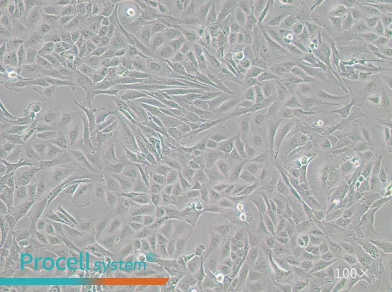 J82 Cell Complete Medium - 1